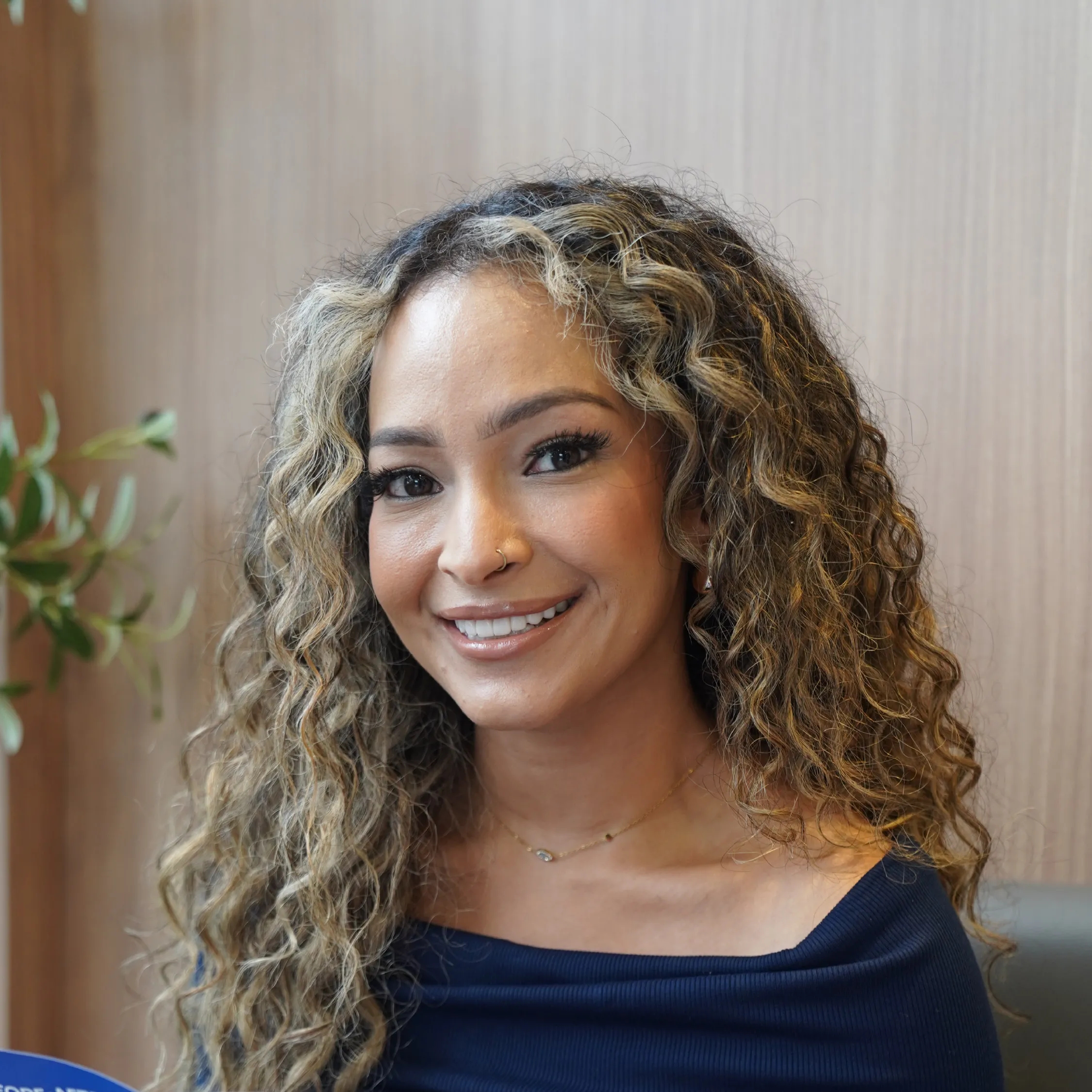 review amirah zerlett veneer gigi di vinir